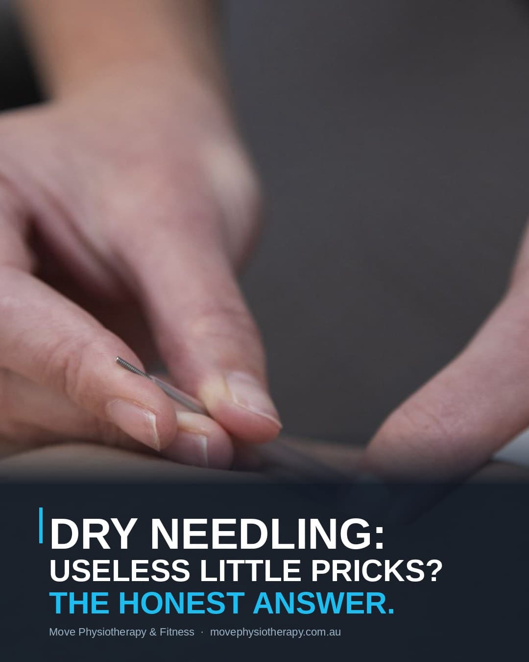 Dry needling treatment