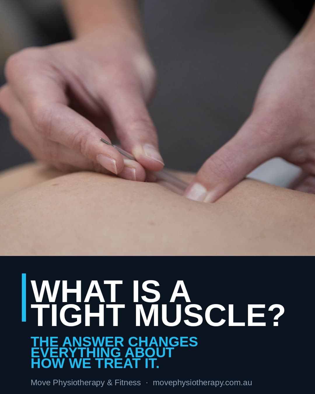 Physiotherapist assessing muscle tension in patient